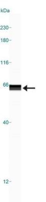 HTR3A Antibody in Western Blot (WB)