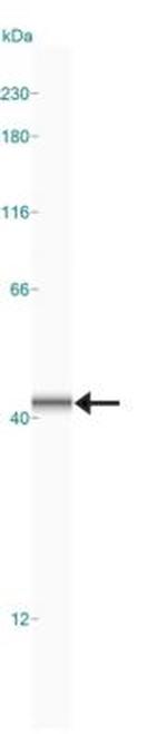 NFATC1 Antibody in Western Blot (WB)