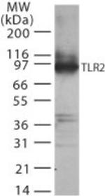 TLR2 Antibody in Western Blot (WB)