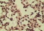 CYLD Antibody in Immunocytochemistry (ICC/IF)