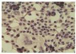 CYLD Antibody in Immunocytochemistry (ICC/IF)