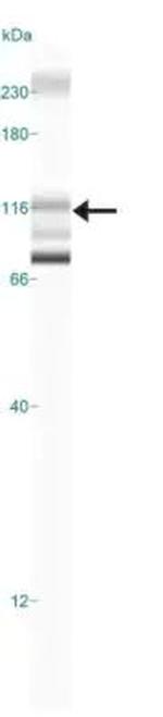 CYLD Antibody in Western Blot (WB)