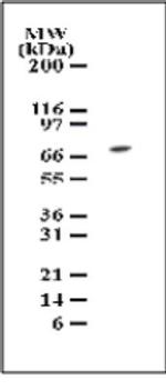 TAK1 Antibody in Western Blot (WB)