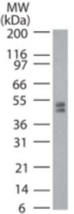 Dnmt2 Antibody in Western Blot (WB)