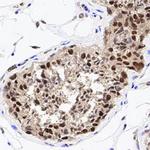 HDAC1 Antibody in Immunohistochemistry (Paraffin) (IHC (P))