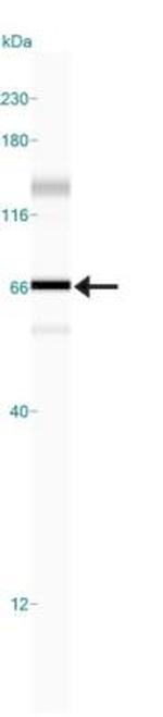 HDAC1 Antibody in Western Blot (WB)