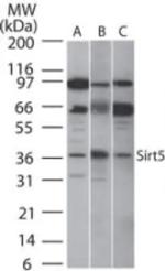 SIRT5 Antibody in Western Blot (WB)