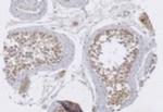 TRIM29 Antibody in Immunohistochemistry (Paraffin) (IHC (P))