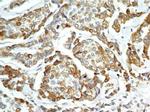 AGR2 Antibody in Immunohistochemistry (Paraffin) (IHC (P))