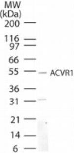 ACVR1 Antibody in Western Blot (WB)