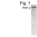 PHF2 Antibody in Western Blot (WB)