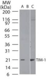 TIM-1 Antibody in Western Blot (WB)