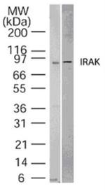 IRAK1 Antibody in Western Blot (WB)