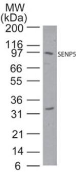 SENP5 Antibody in Western Blot (WB)