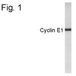 Cyclin E Antibody in Western Blot (WB)