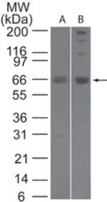 SENP2 Antibody in Western Blot (WB)