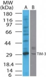 TIM3 Antibody in Western Blot (WB)