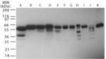 RNF216 Antibody in Western Blot (WB)