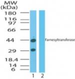 FNTA Antibody in Western Blot (WB)