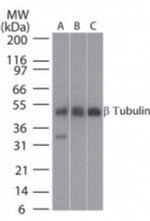 beta Tubulin Antibody in Western Blot (WB)