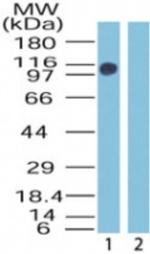 ZMYM2 Antibody in Western Blot (WB)