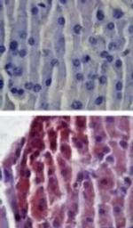 TLR2 Antibody in Immunohistochemistry (IHC)