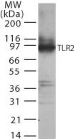 TLR2 Antibody in Western Blot (WB)