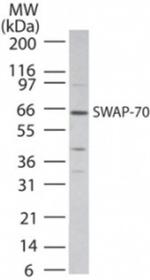 SWAP70 Antibody in Western Blot (WB)