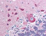 PACSIN2 Antibody in Immunohistochemistry (Paraffin) (IHC (P))