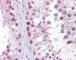 MRE11 Antibody in Immunohistochemistry (Paraffin) (IHC (P))