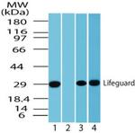 LFG Antibody in Western Blot (WB)