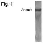 Artemis Antibody in Western Blot (WB)