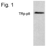 TRPM8 Antibody in Western Blot (WB)