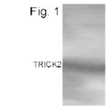 TRAIL-R2 (DR5) Antibody in Western Blot (WB)