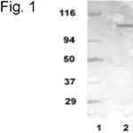 mGluR1 Antibody in Western Blot (WB)