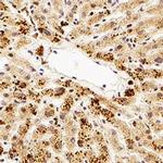 TMP21 Antibody in Immunohistochemistry (Paraffin) (IHC (P))