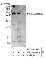 CIC Antibody in Immunoprecipitation (IP)