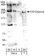 CIC Antibody in Western Blot (WB)