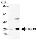 PTGDS Antibody in Western Blot (WB)