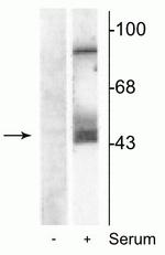 Phospho-MEK1/MEK2 (Ser217, Ser221) Antibody in Western Blot (WB)