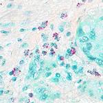 FOXP3 Antibody in Immunohistochemistry (Paraffin) (IHC (P))