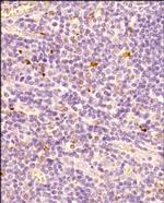 FOXP3 Antibody in Immunohistochemistry (Paraffin) (IHC (P))