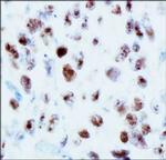 53BP1 Antibody in Immunohistochemistry (Paraffin) (IHC (P))