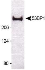 53BP1 Antibody in Western Blot (WB)