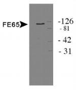 Fe65 Antibody in Western Blot (WB)