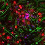 PGP9.5 Antibody in Immunocytochemistry (ICC/IF)