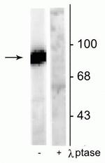 Phospho-Dynamin 1 (Ser778) Antibody in Western Blot (WB)