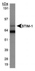 STIM1 Antibody in Western Blot (WB)