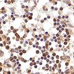 p16INK4a Antibody in Immunohistochemistry (Paraffin) (IHC (P))