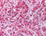 TRPM8 Antibody in Immunohistochemistry (Paraffin) (IHC (P))